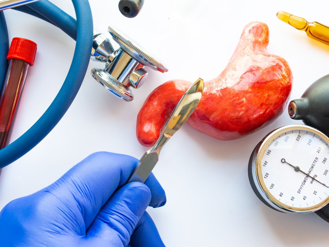 Cirurgia bariátrica